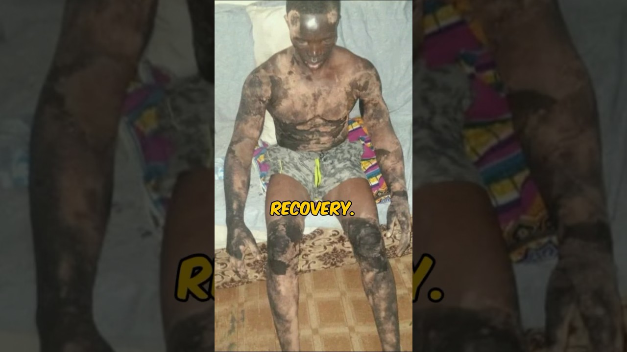 🚨Shocking🚨What happened to this African Bodybuilder😱 #shorts #bodybuilding #gymlife